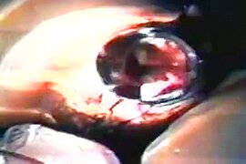 張家靜(護士)(人妻)(台灣本土)(淫蕩性交自拍)zhangjiajing nurses taiwan taiwanese nurses(05 - free porn video