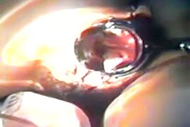 張家靜(護士)(人妻)(台灣本土)(淫蕩性交自拍)zhangjiajing nurses taiwan taiwanese nurses(1 - free porn video